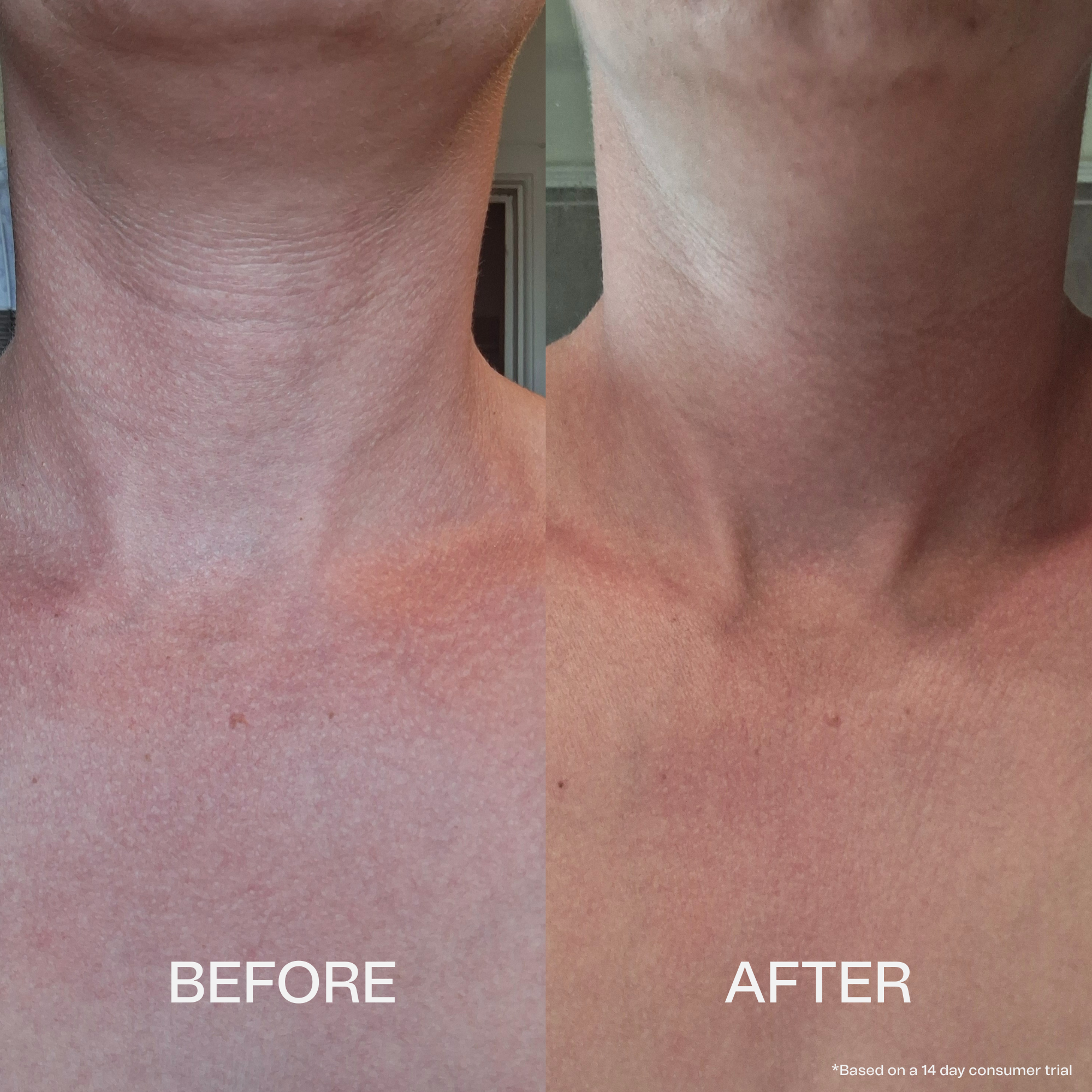 Collagen Neck Firming Serum