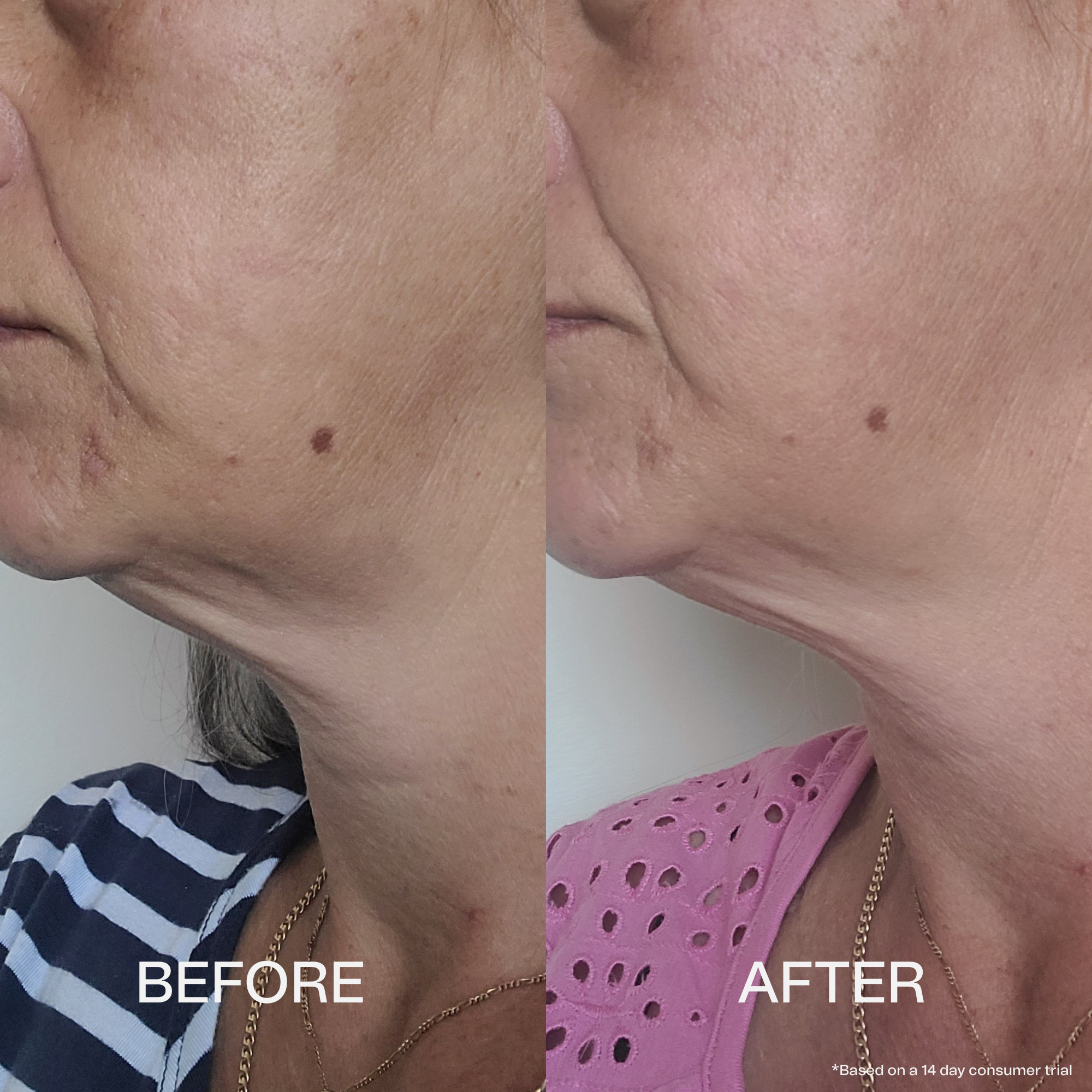 Collagen Neck Firming Serum