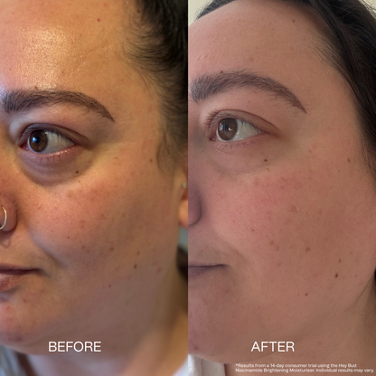 Niacinamide Brightening Moisturiser