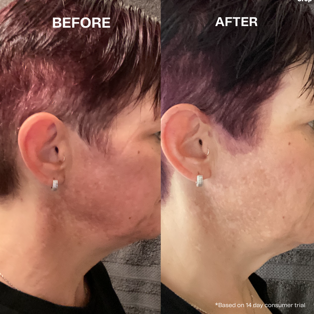 Pigmentation Treatment (30ml)