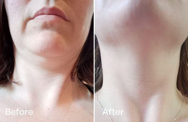 Before and After Courtney S.