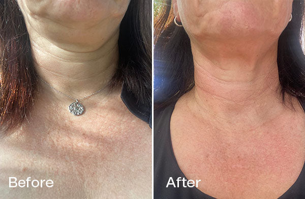 Before and After Liz B.