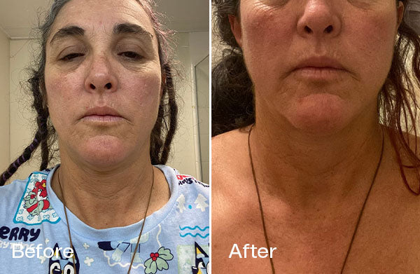 Before and After Michelle T.