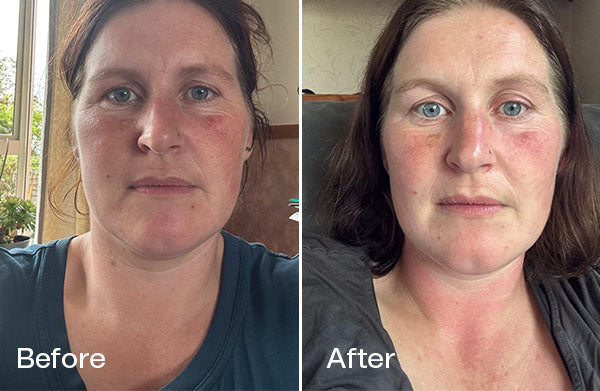 Before and After Nicole D.