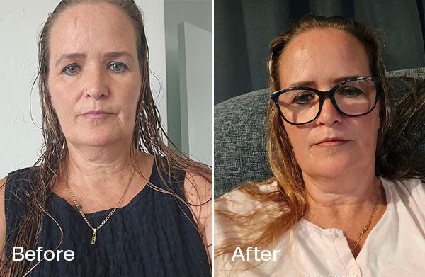 Before and After Allison M.