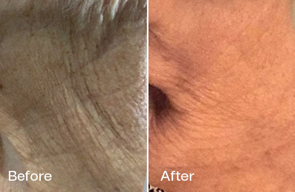 Before and After Barbara S.