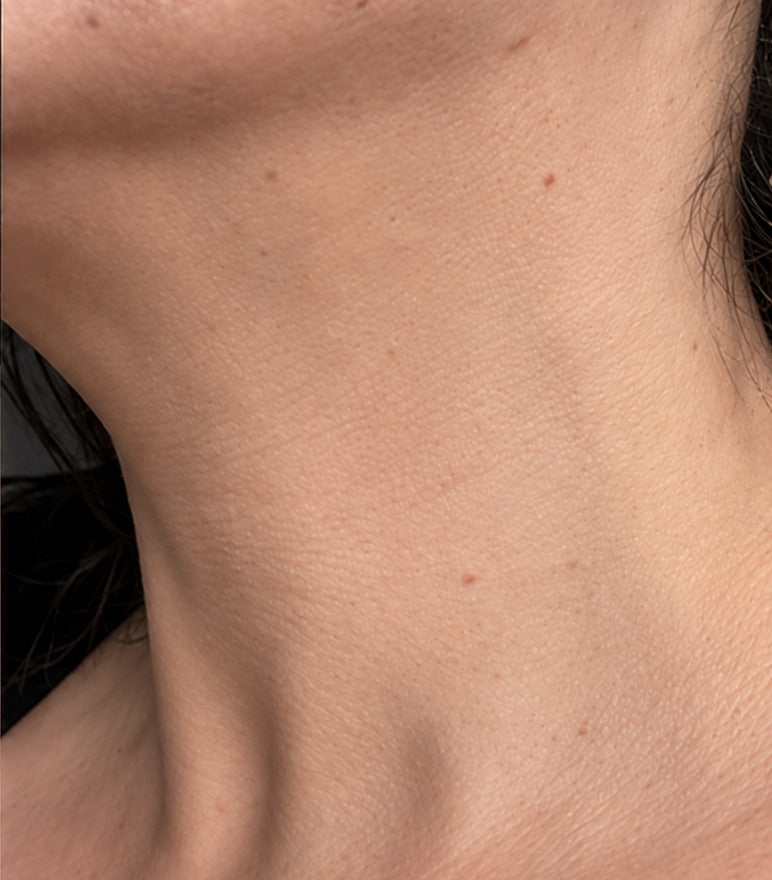 Krissy P. after using the serum