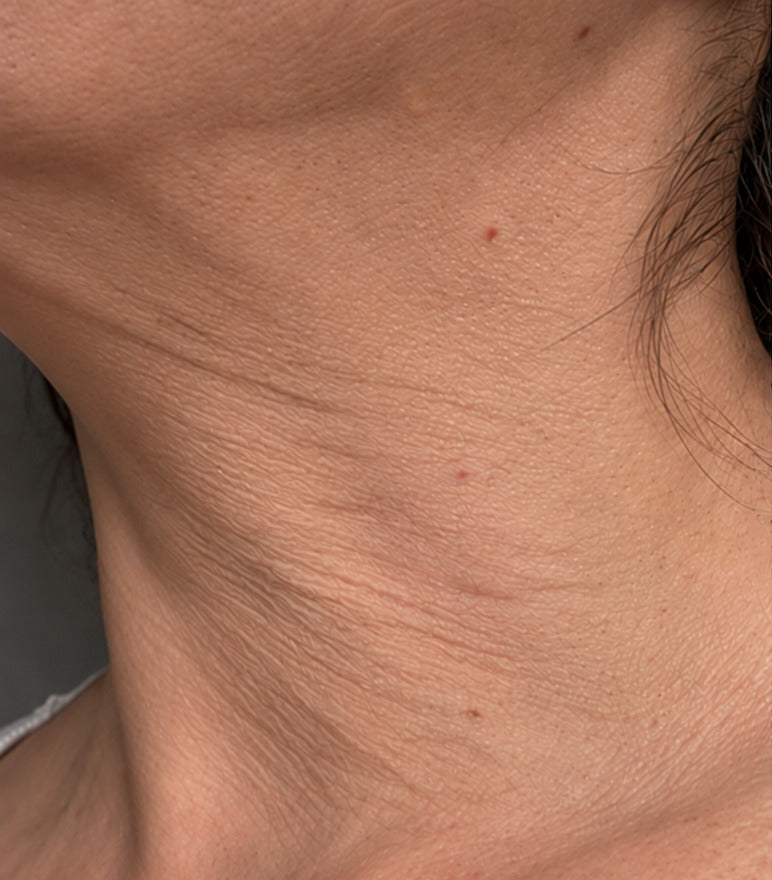 Krissy P. before